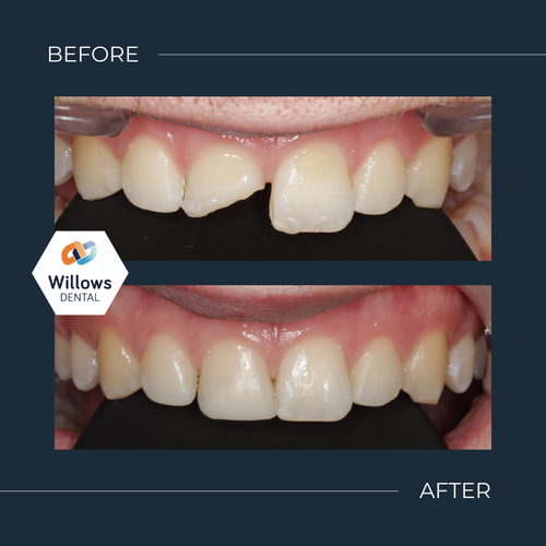 Restorative Treatments